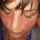 Profile picture of Autoimmune disease
