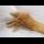 Profile picture of Arthritis