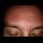 Profile picture of Acne