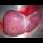 Profile picture of Liver transplantation