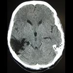 Profile picture of brain injury